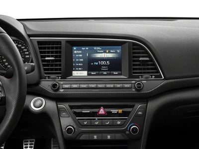 2017 Hyundai Elantra Sport